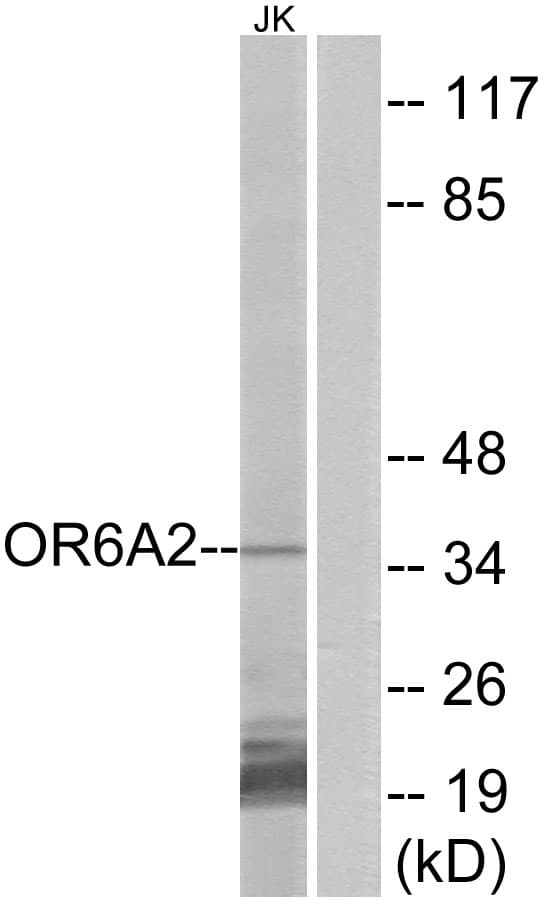 OR6A2 Antibody (aa58-107)