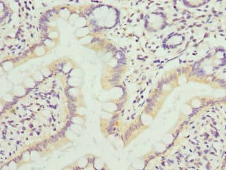 Polyclonal Rabbit anti-Human KIF1B / CMT2 Antibody (IHC)