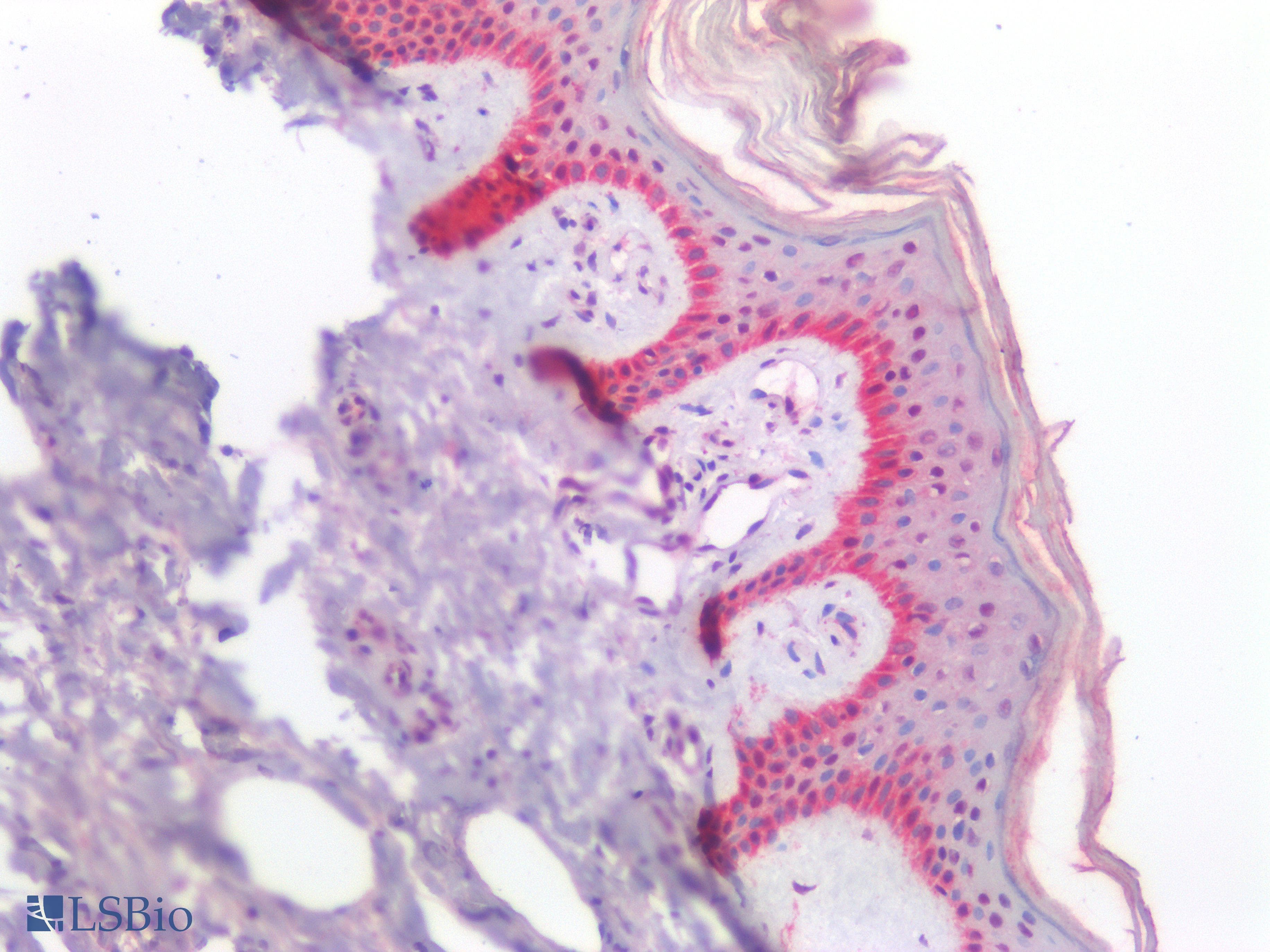 PathPlus™ LAMA1 / Laminin Alpha 1 Antibody