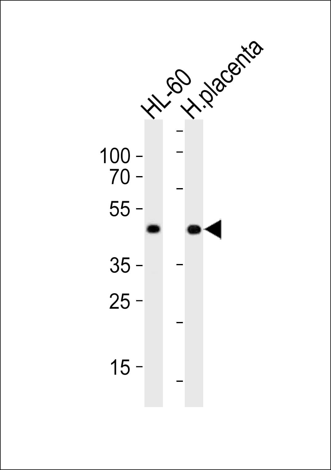 IHC-plus™ MYOD / MYOD1 Antibody (aa211-240)