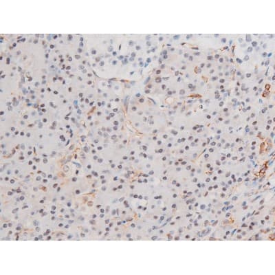 LIMK2 Antibody (phospho-Ser283)