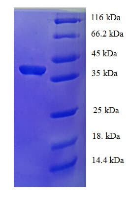 Human USF1 / USF Protein (Recombinant His)