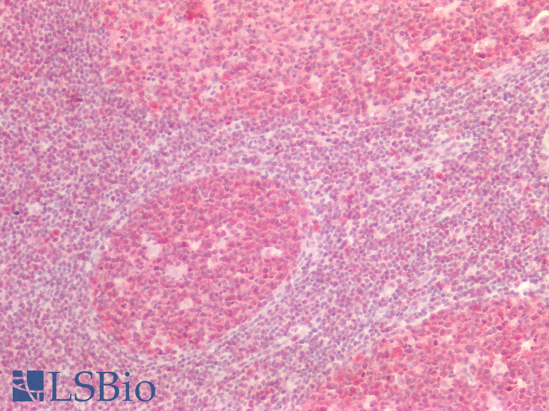 PathPlus™ DNMT / DNMT1 Antibody (aa637-650, clone 60B1220.1)