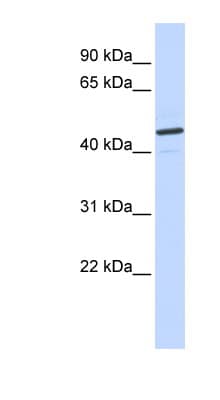 CATSPER2 Antibody (aa31-80)