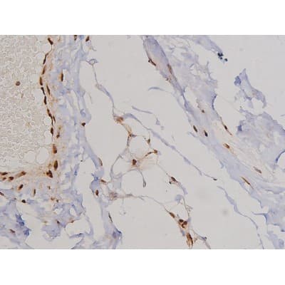 FAK / Focal Adhesion Kinase Antibody (phospho-Tyr397)