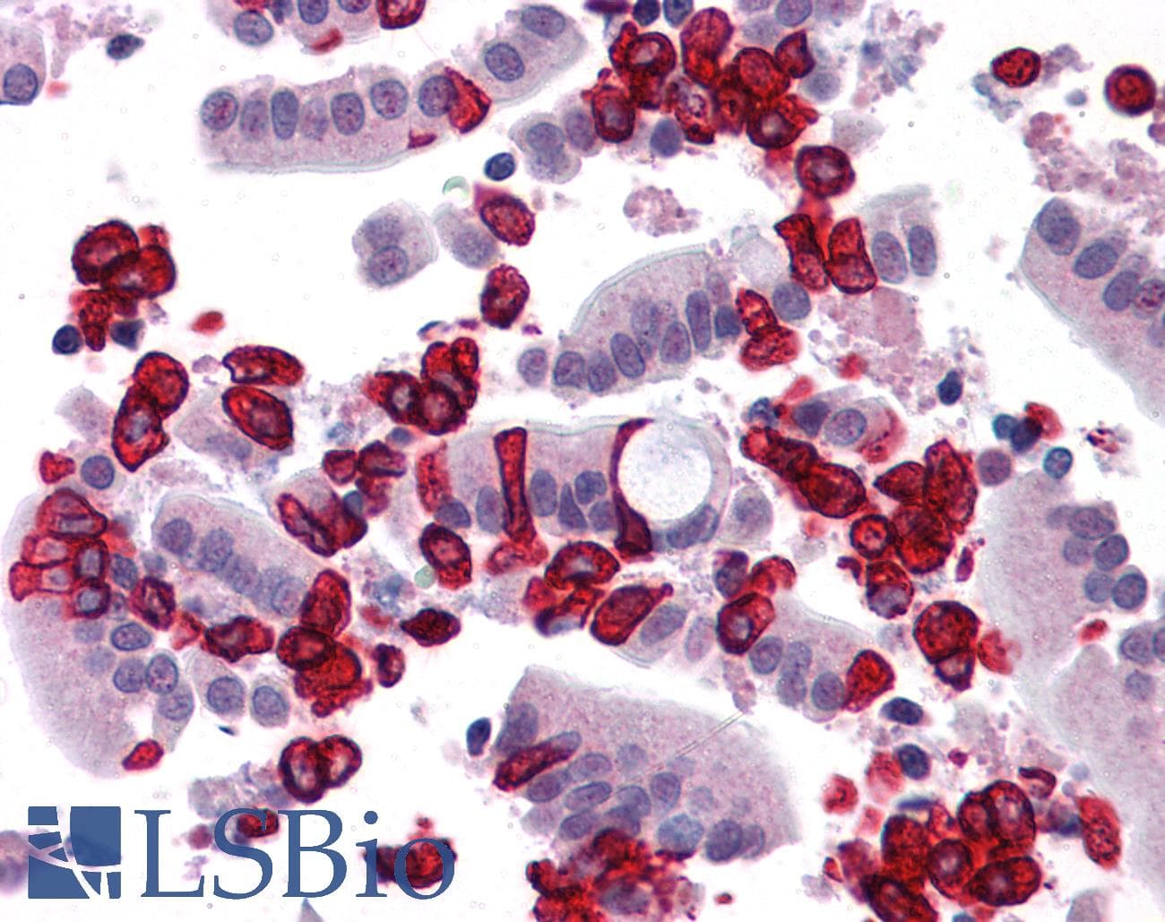 IHC-plus™ Polyclonal Rabbit anti-Human CHORDC1 / CHP1 Antibody (IHC, IF, WB)