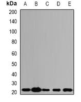 PDCD6 / ALG-2 Antibody