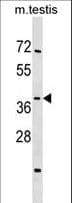 SIRT4 / Sirtuin 4 Antibody (aa67-95)