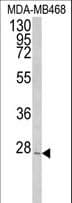 Polyclonal Rabbit anti-Human PEX11A Antibody (aa1-30, IHC, WB)