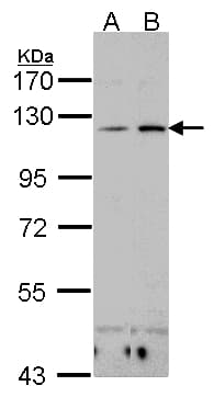 ITGAX / CD11c Antibody (aa1-168)