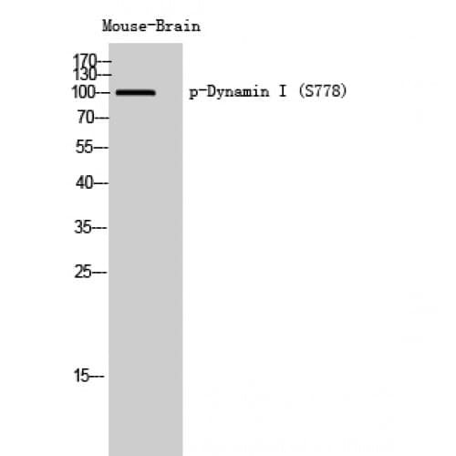 DNM1 / Dynamin Antibody (720-800 aa)
