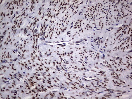 Monoclonal Mouse anti-Human TLK2 Antibody (clone OTI2G1, aa1-296, IHC, WB)