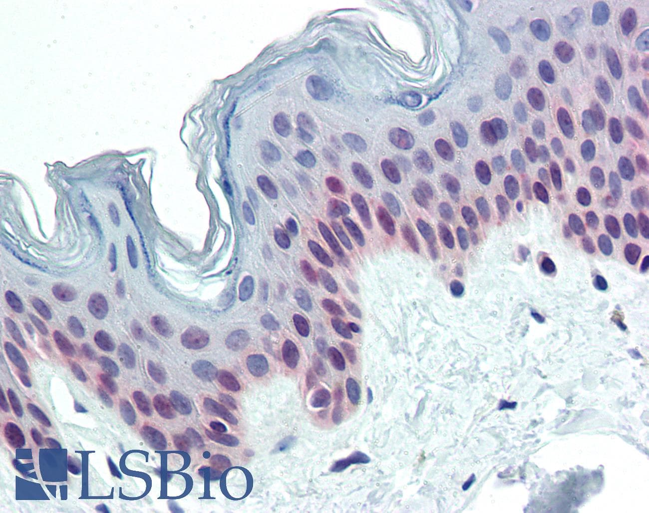 IHC-plus™ Monoclonal Mouse anti-Human PARP1 Antibody (clone A6.4.12, IHC, IF, WB)