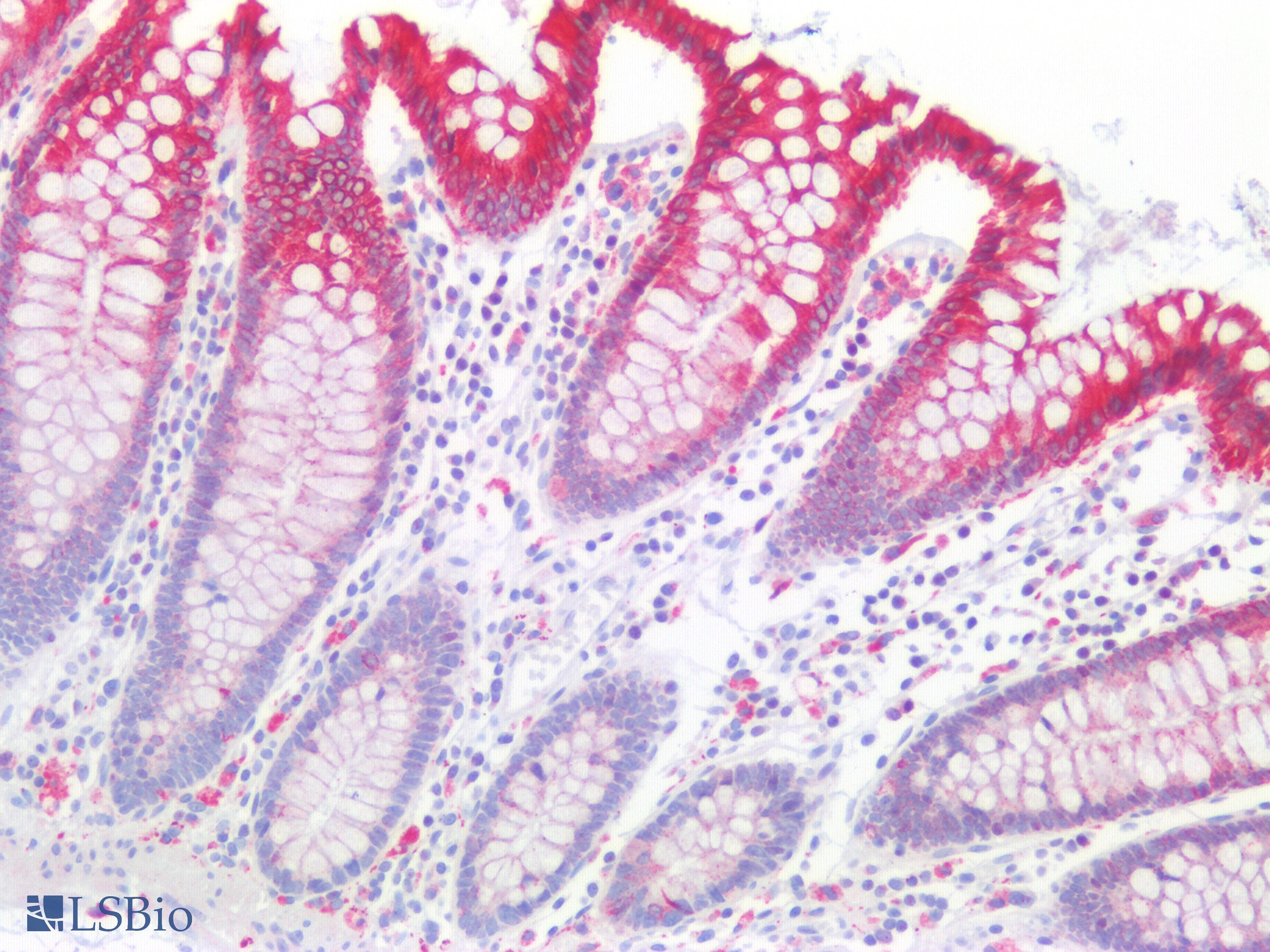 PathPlus™ KRT5 / CK5 / Cytokeratin 5 Antibody (C-Terminus)