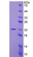 Mouse ADM / Adrenomedullin Protein (Recombinant His, N-Terminal)