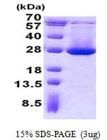Human ADI1 / ARD Protein (Recombinant His)