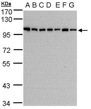 HPS3 Antibody (aa942-1004)