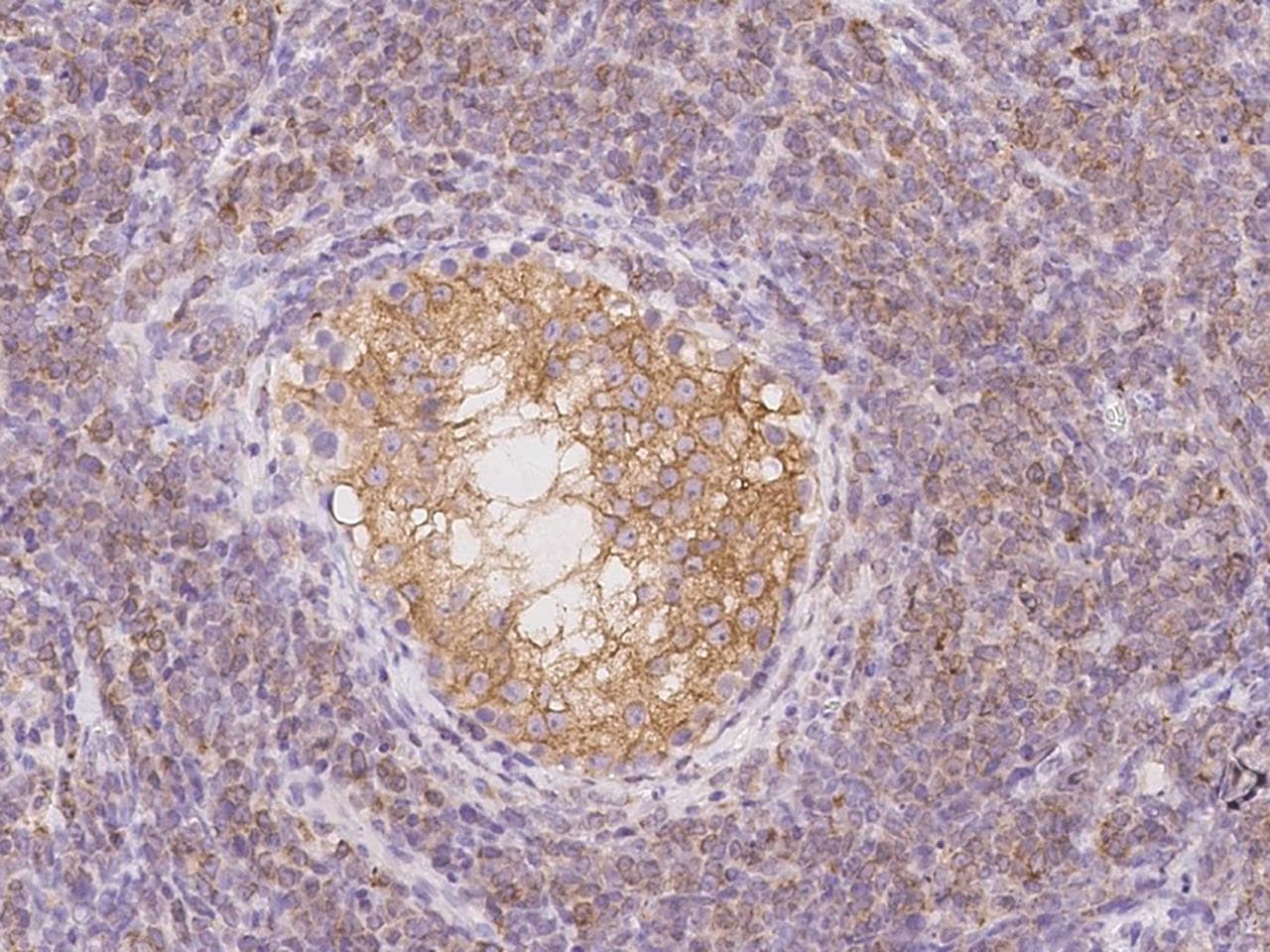 TEX264 Antibody
