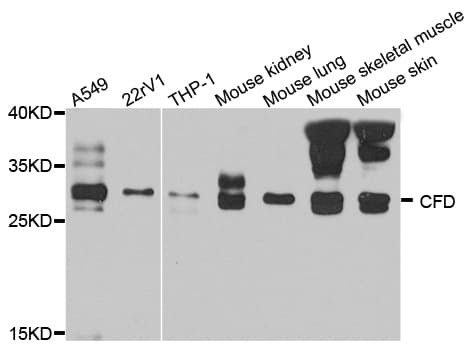 IHC-plus™ CFD / Factor D / Adipsin Antibody