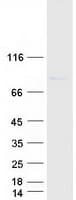 Human FBXO42 / JFK Protein (Recombinant Myc-DDK (Flag))