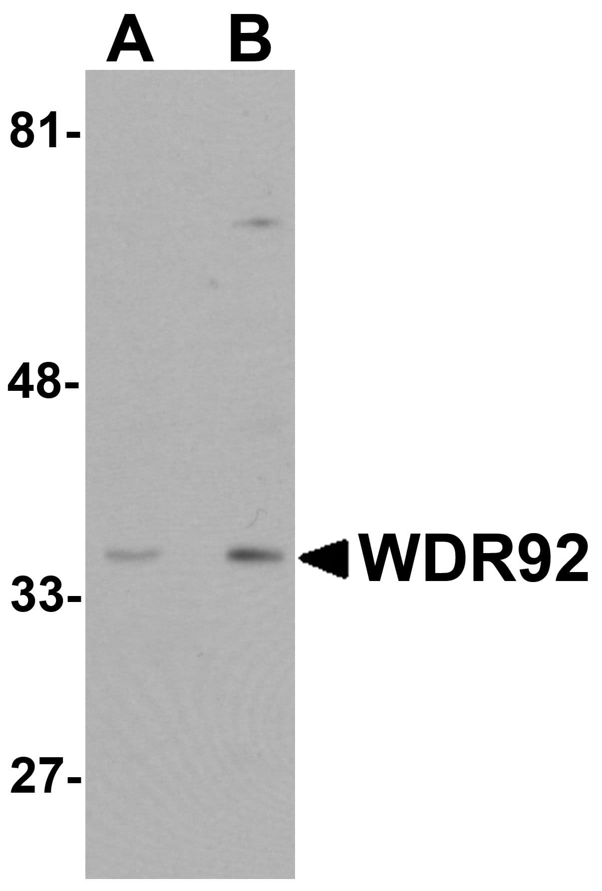 IHC-plus™ Polyclonal Rabbit anti-Human WDR92 Antibody (IHC, IF, WB)