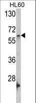 GNL3 / NS / Nucleostemin Antibody (aa458-487)