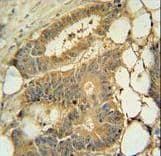 EPS8L3 Antibody (aa1-30)