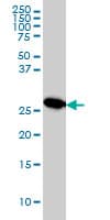 MTAP Antibody (clone 2G4)