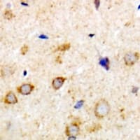 RPH3A / Rabphilin 3A Antibody (Internal)