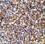 CLP / COTL1 Antibody (aa115-142)