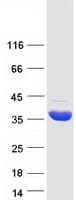 Human HIBADH Protein (Recombinant Myc-DDK (Flag))
