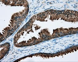 RDH11 Antibody (clone OTI1B4)