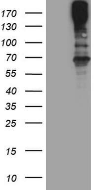 MAST205 / MAST2 Antibody (aa1482-1798, clone OTI3A5)