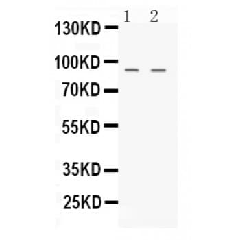 NIRF / UHRF2 Antibody (aa15-54)