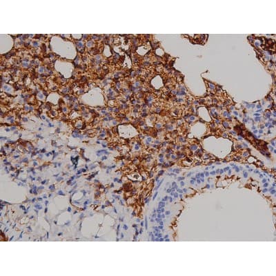 Polyclonal Rabbit anti-Human ZAP70 Antibody (phospho-Tyr319, IHC, IF, WB)