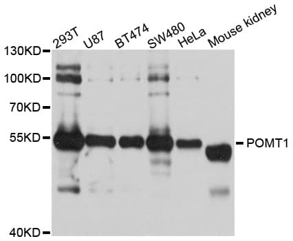 Polyclonal Rabbit anti-Human POMT1 Antibody (WB)