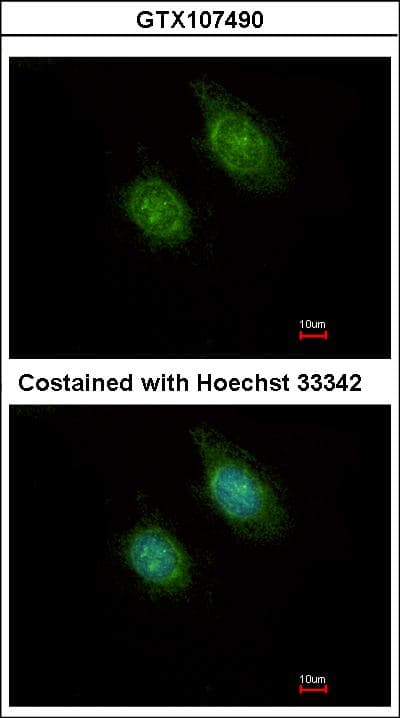 CAMK1D Antibody (aa1-205)