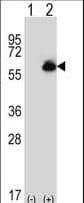 P5CDH / ALDH4A1 Antibody (aa533-561)
