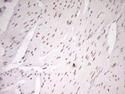 HMG20A Antibody (aa1-281, clone OTI2H4)