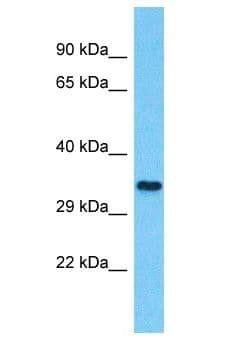 Polyclonal Rabbit anti-Human NTN5 Antibody (aa276-325, WB)