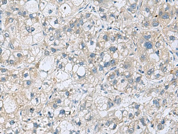 Polyclonal Rabbit anti-Human KCNJ2 / Kir2.1 Antibody (IHC)