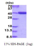 Human MTHFD2 Protein (Recombinant His)