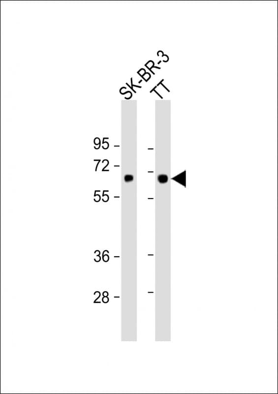 Polyclonal Rabbit anti-Human SLC5A8 / AIT Antibody (aa579-609, WB)