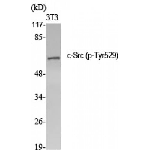 Polyclonal Rabbit anti-Human SRC Antibody (460-540 aa, IHC, WB)