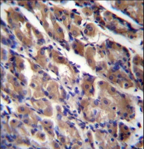 Polyclonal Rabbit anti-Human STARS / ABRA Antibody (aa275-304, IHC, WB)