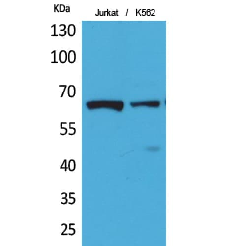 RELA / NFKB p65 Antibody (acetylation site of K218.)