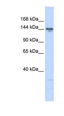 TBC1 / TBC1D1 Antibody (aa612-661)