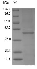 Rat KMO Protein (Recombinant 6His-SUMO, N-terminus)
