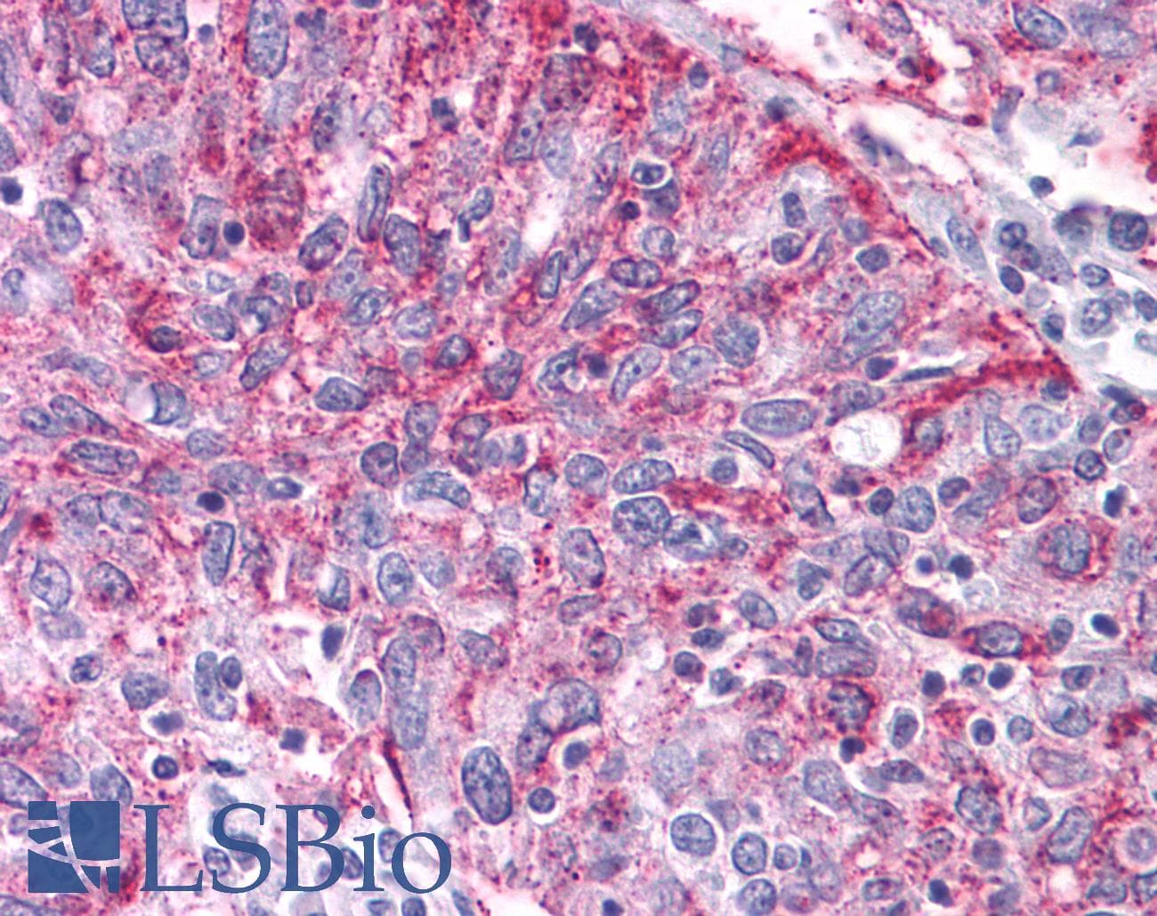 IHC-plus™ NPY2R Antibody (C-Terminus)