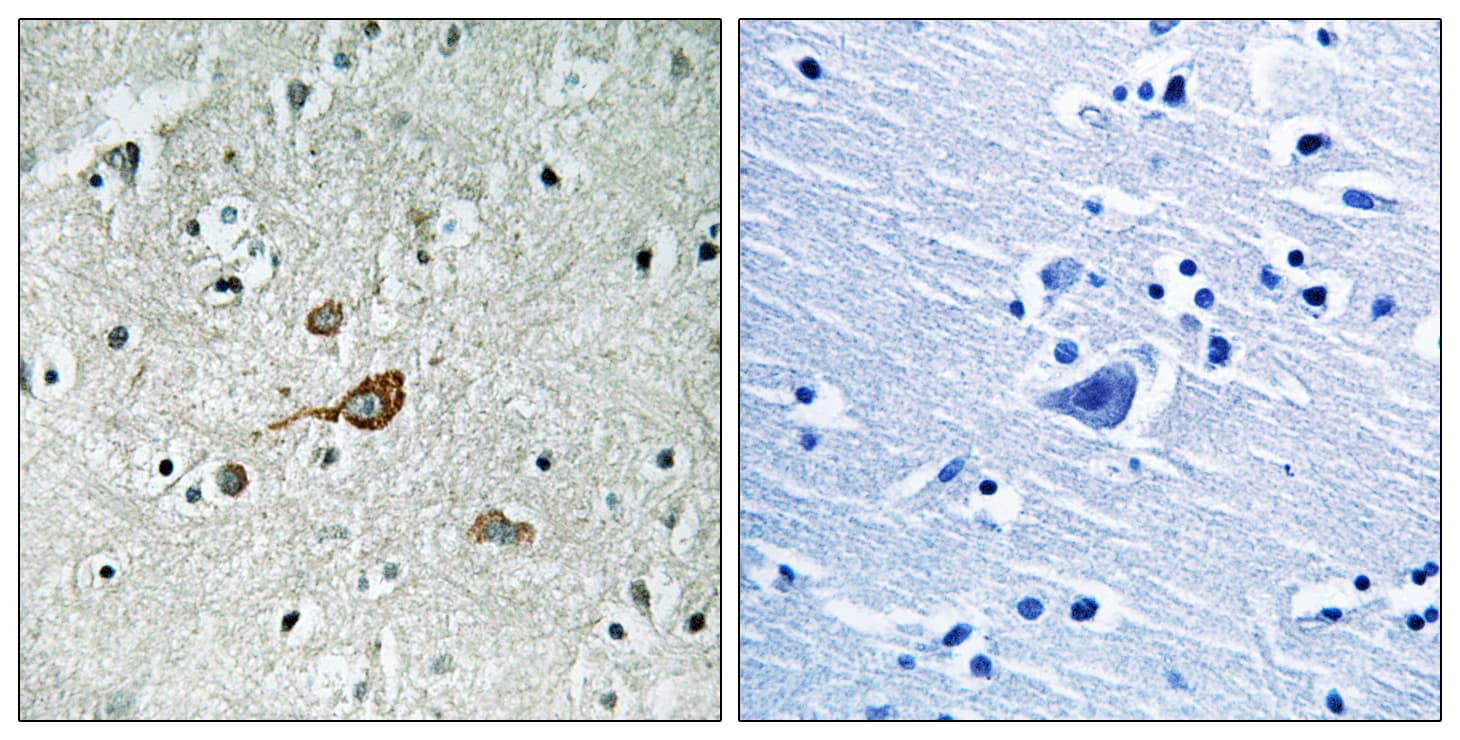 Polyclonal Rabbit anti-Human ABL Antibody (aa406-455, IHC, WB)